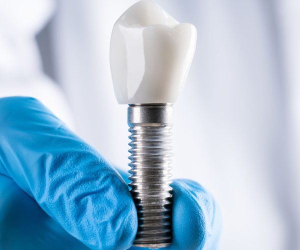 Clinica dental en San Cristobal de La Laguna (3) Clinica dental en San Cristobal de La Laguna (3)