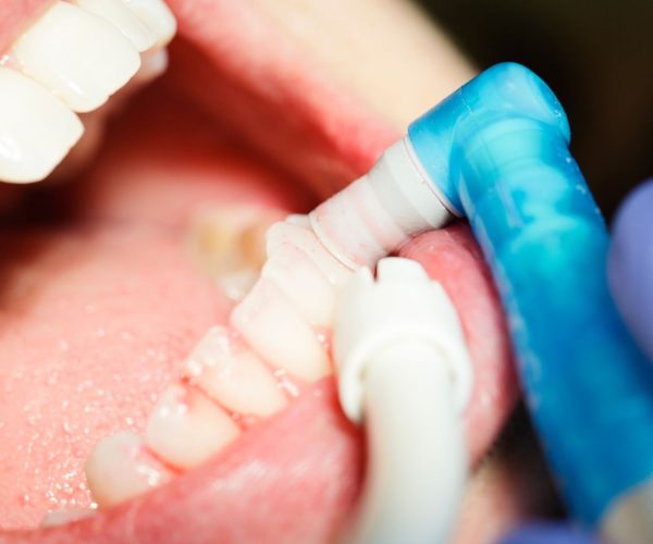 Clinica dental en San Cristobal de La Laguna (7) Clinica dental en San Cristobal de La Laguna (7)